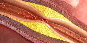 Apa aterosklerosis dan bagaimana mencegahnya