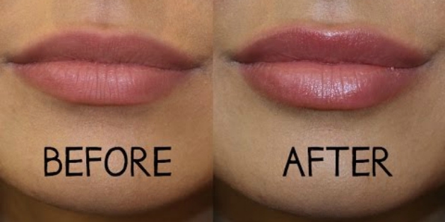 menghemat kosmetik: pembesaran bibir